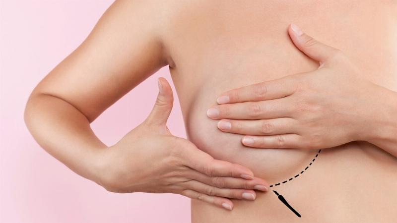 Mát-xa ngực kích thích tuyến sữa
