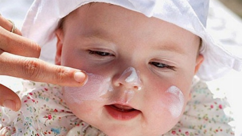 Cách chữa trị chàm sữa ở trẻ: Giữ ẩm, tránh kích ứng và dùng thuốc