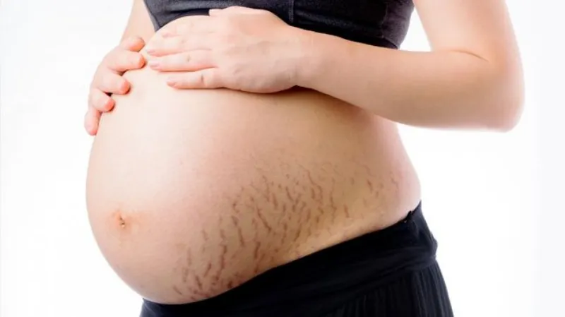 Cách Sử Dụng Kem Trị Rạn Da Cho Bà Bầu Hiệu Quả