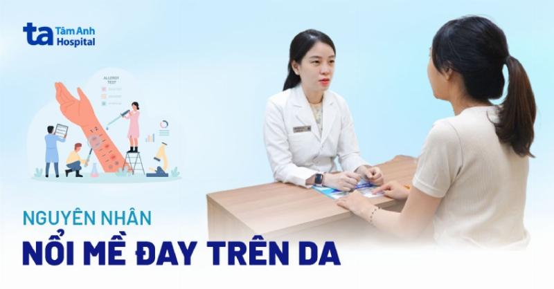 Tác nhân môi trường gây mề đay