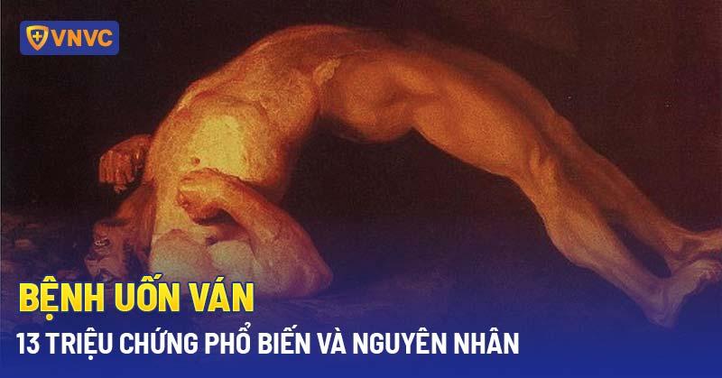 Triệu chứng bệnh uốn ván